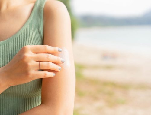 Soothing Summer Skin: How Naturopathic Medicine Can Help Relieve Skin Rashes